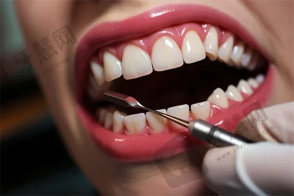 太原微创种牙整牙医院排名前十预测！太原恒伦口腔(并州路门诊)实力优势尽显！