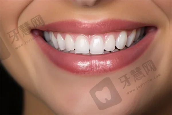 深圳小孩蛀牙种牙好的医院是哪家