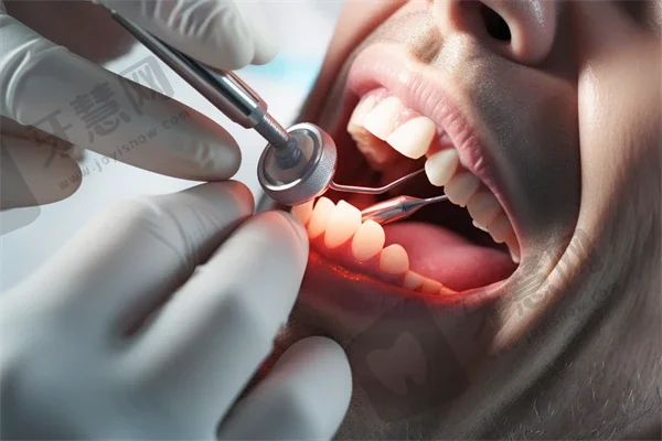 兰州台牙口腔团结路门诊部种植牙质量评价