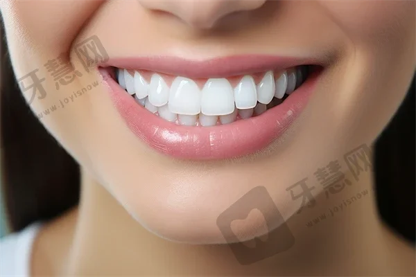 西安国产种牙最好的口腔医院是哪家