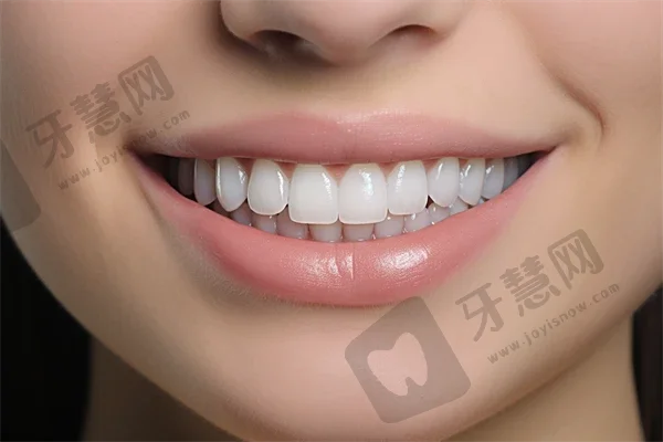 成都四川省人民医院口腔科种植牙质量如何