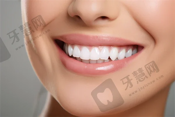 杭州开乐口腔诊所种植牙结果如何