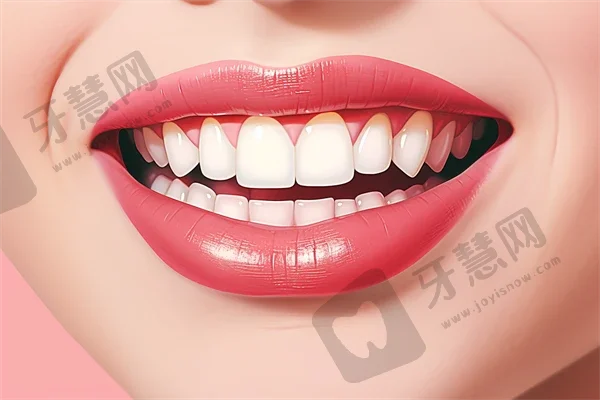 广州紫馨口腔中心种植牙质量如何