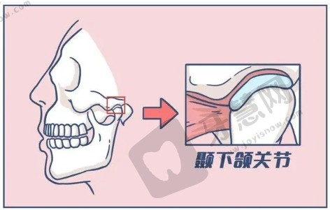 下颌关节疾病