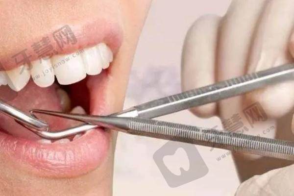 张家口麦格口腔医院矫正牙齿多少钱