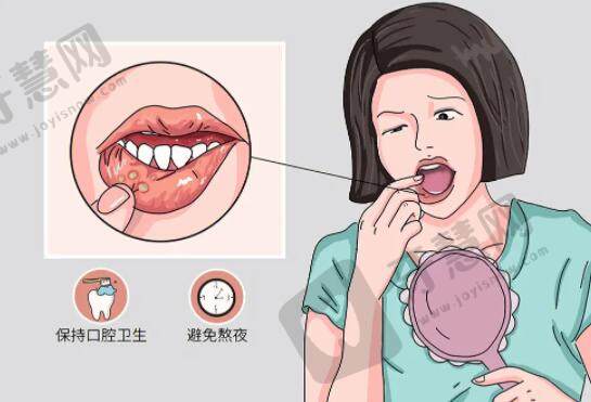 如何治疗口腔溃疡和预防口腔溃疡？提供4个参考方案