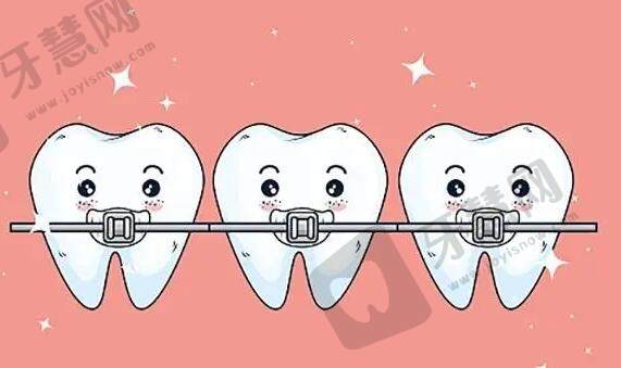 牙齿矫正后悔一辈子是真的吗？做正畸应该注意哪些问题？