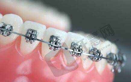 一个牙医的良心忠告：牙医不会告诉你的事！看牙注意事项