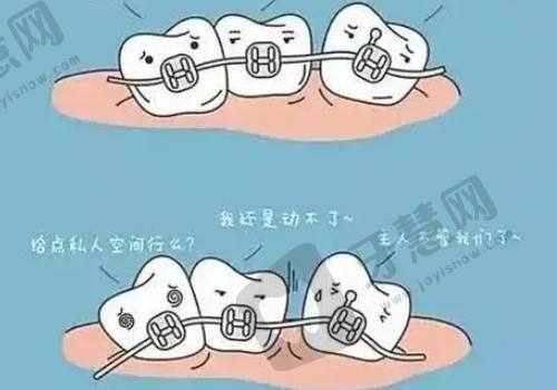 牙齿矫正5.jpg