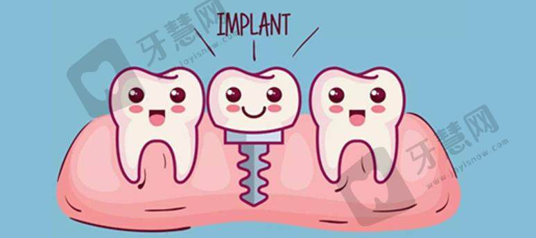 北京繁星医美种植牙价格多少钱？贵不贵呢？种植牙可以使用多久呢