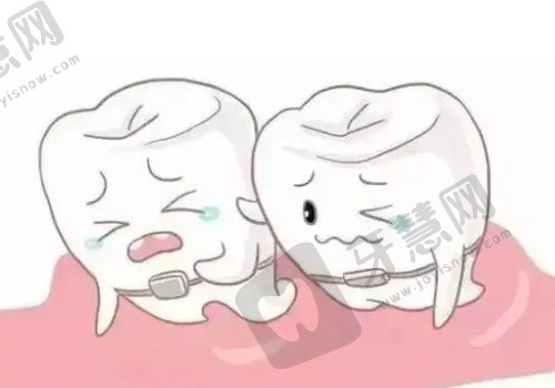 武汉同济医院种植牙齿1棵多少钱？内含医生详细信息介绍！