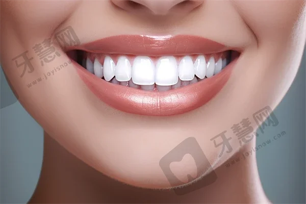 台州再福口腔：超声波洗牙种牙效果好吗？最新案例反馈＋科室简介