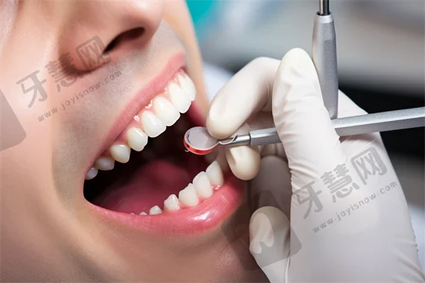 重庆最好的牙科医院名单揭晓！收藏这份名单！