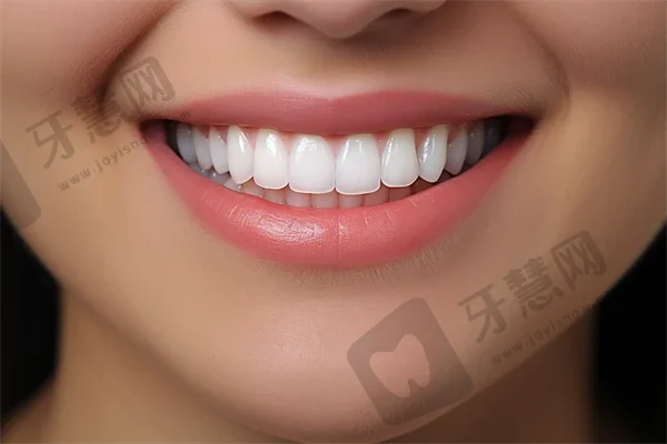 泰安全口种牙牙科医院排名榜公布（最新）！新泰康嘉口腔实力强更安全！