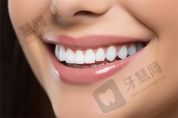 杭州牙齿涂氟口腔医院排名重磅发布！杭州牙管家口腔(钱江店)医疗水平高！