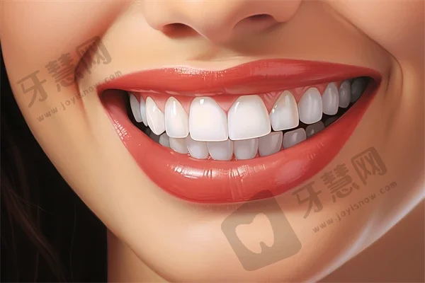 杭州美白牙齿牙科医院排名榜公布（最新）！富阳名禾口腔实力得到认可！