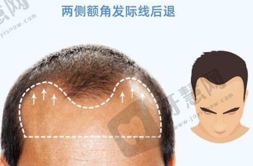 2025吉林大学第(一)医院整形美容外科价格表！热门项目价格表大揭秘