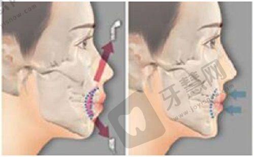 五、北京美莱医疗美容医院——业务广泛的靠谱整容医院