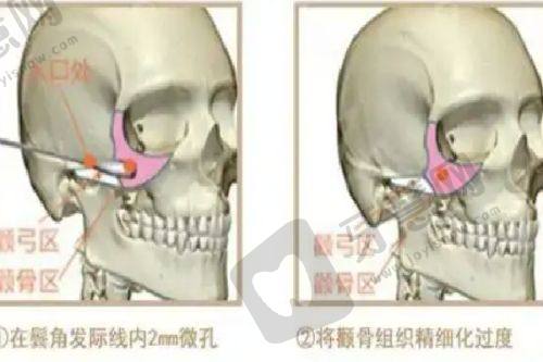 北京优梵医疗美容医院引导