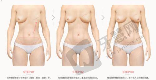 邯郸华美整形医疗美容医院——经验多交通便利的整形医院