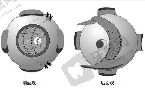 乌鲁木齐474空军眼科怎么样？设备优医生强西北区眼科排名前十