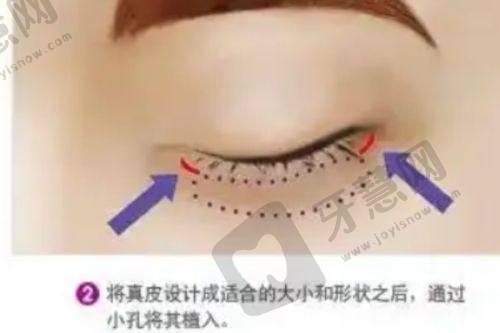 北京艺美硕德整形医院价格参考
