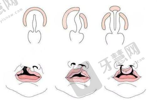 合肥艺星医疗美容医院——专注面部填充与注射美容
