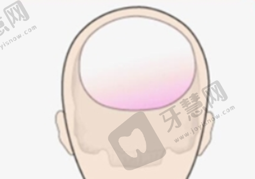 南京连锁医美做双眼皮手术优势盘点