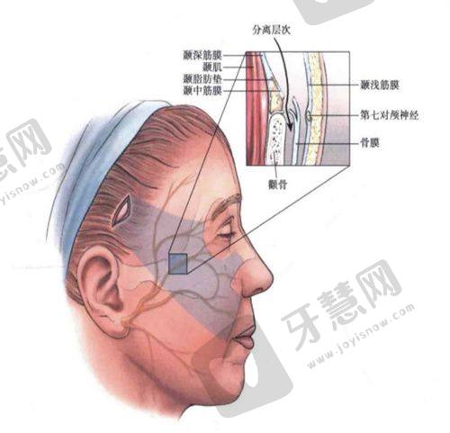 北京打玻尿酸的正规医院——北京蒂凡妮医疗美容