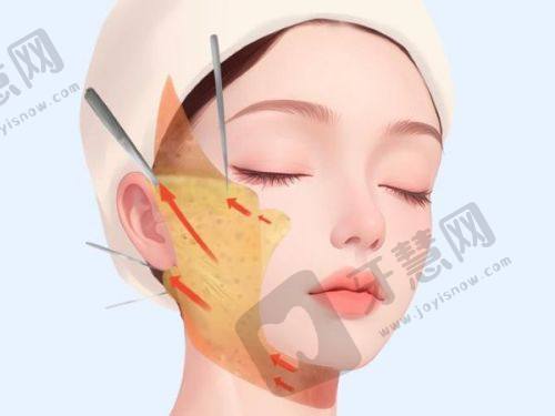 北京清木医疗美容诊所及沈薇医生