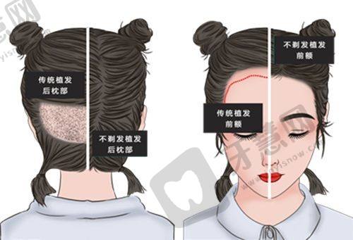 成都武侯天使之翼总院价格表 / 收费标准