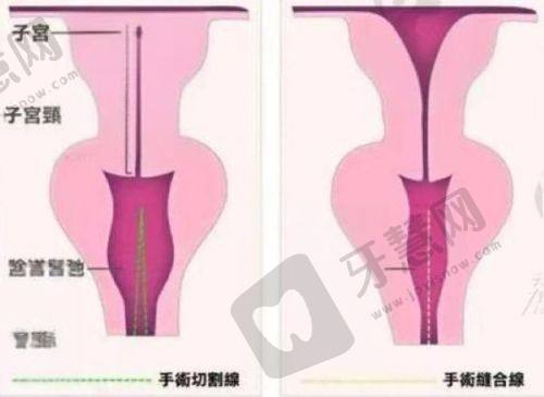 北京蕾士悦医疗美容及王晓健医生