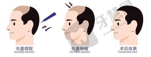 合肥吴氏佳美医疗美容——经典整形项目性价比高