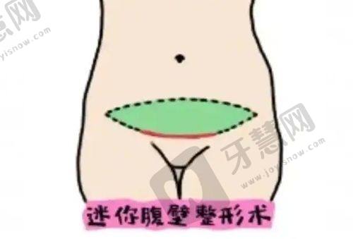 辽宁曙光整形外科医院：技术不错，打造沈阳玻尿酸垫下巴自然成效