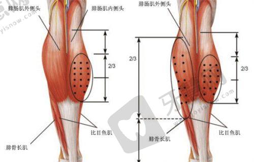 北京苏敬达做拇外翻价格+医院地址分享，海淀圣嘉新治拇外翻价优且靠谱