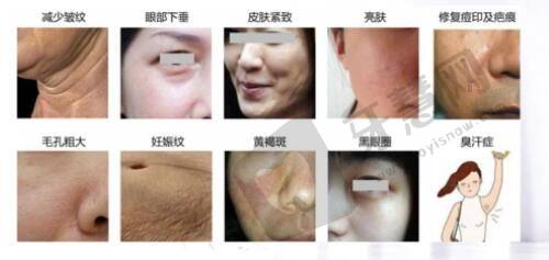 北京艺美硕德整形医院怎么样？医生技术精湛口碑好，价格合理可线上预约挂号