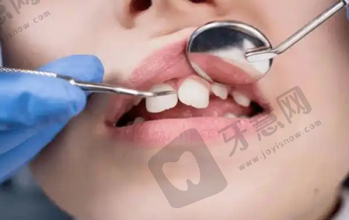 巴彦淖尔贝齿口腔门诊部价格参考