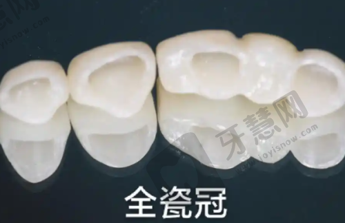 山东聊城茌平谢冉口腔特色项目及技术优势
