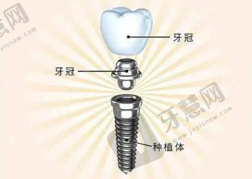 巴彦淖尔贝齿口腔门诊部口碑反馈