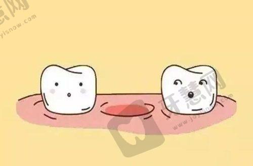 拔智齿好的医院排名之海口微笑口腔连锁医院