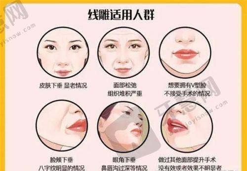 沈阳杏林整形外科医院：专精塑美，成就沈阳玻尿酸垫下巴之美