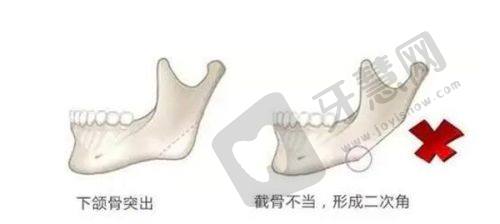 安庆好梦医美整形怎么样——医院口碑反馈