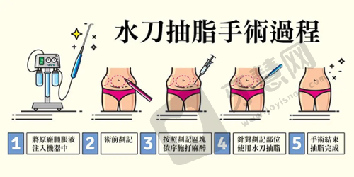 影响疤痕修复手术费用的因素