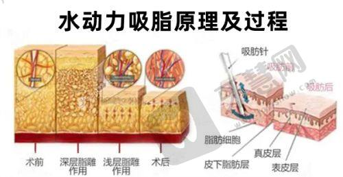 2025南京十大割双眼皮名医揭晓，集中艺星、美莱等连锁医美
