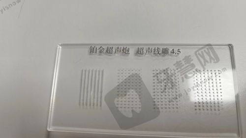 北京人中缩短手术选择建议总结