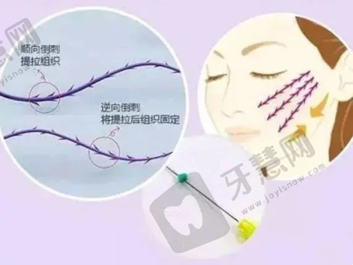 选择南京双眼皮医生的5大黄金准则