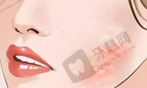 合肥壹加壹美容医院——新型微创整形技术优势明显