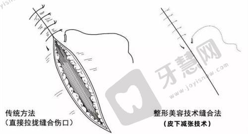 沈阳北方整形医院：强大团队，精细塑造沈阳玻尿酸垫下巴之美