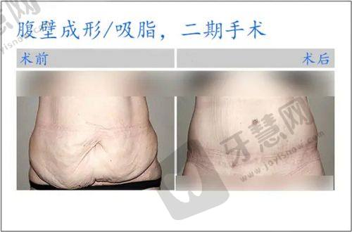北京艺美硕德整形医院地址与挂号指南