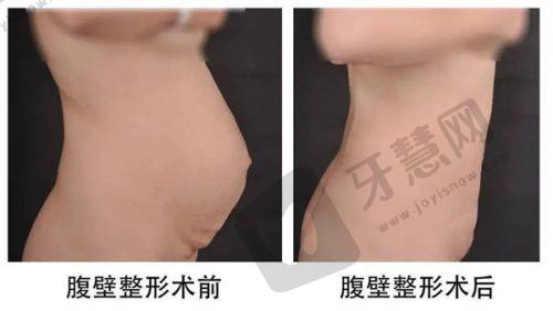 北京杏林美医疗美容医院价格参考